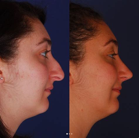 plastic surgeon rancho cucamonga|cosmetic surgery rancho cucamonga.